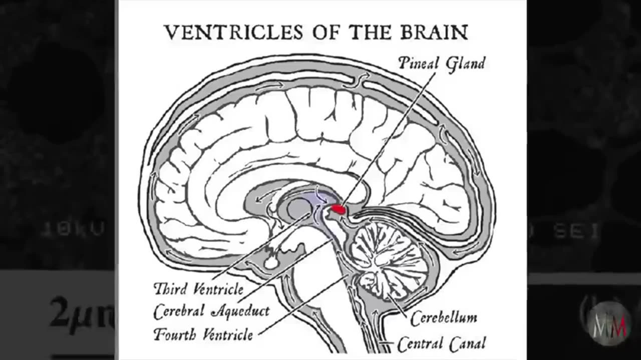 Pineal Gland Activation By Dr Joe Dispenza 1032