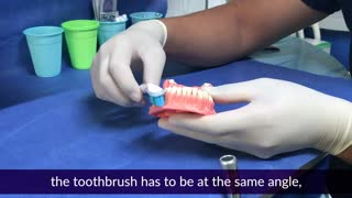 How to Brush your Teeth Correctly