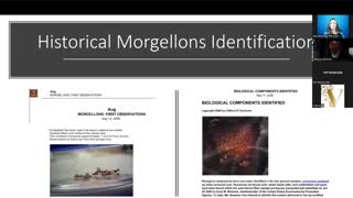 Synthetic Biological Life Forms – CDB, Morgellons, Live Blood Findings in Post C19 Injection Era